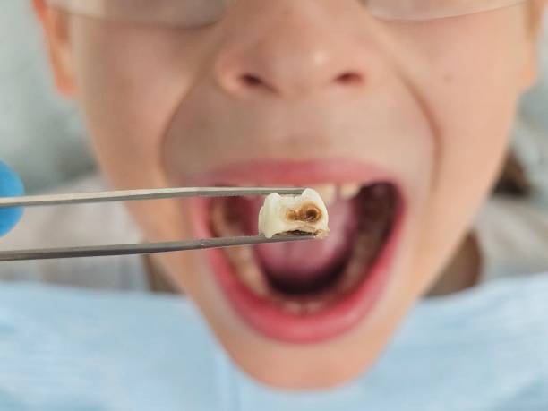 Best Emergency Root Canal Therapy in Orange Blossom, CA
